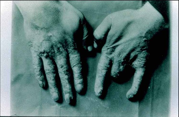 Pic 2. Madame-Curies-Hands-838e01a68f